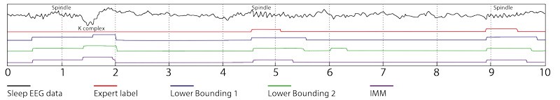 An example of the sleep EEG data (black line), labelled as either a sleep spindle or K complex by an algorithm adapted by Ms Tracey Camilleri. The lines below compare an expert’s labeling (red line) with the computer programme (blue, green, and purple).  