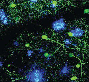 Amyloid plaque deposition (blue) in the brain of a mouse model of Alzheimer’s disease (neurons in green). 